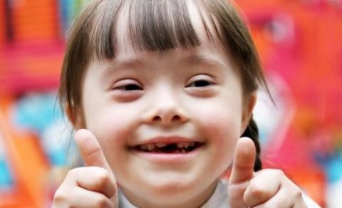 Alþjóðlegur dagur um Downs heilkenni